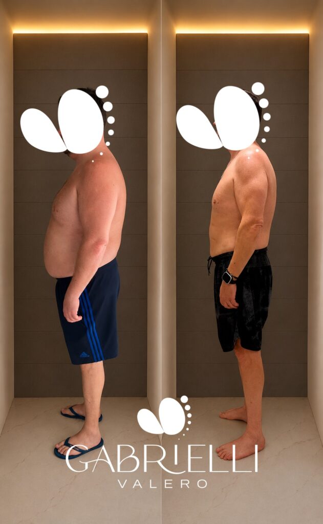 Antes e depois do acompanhamento